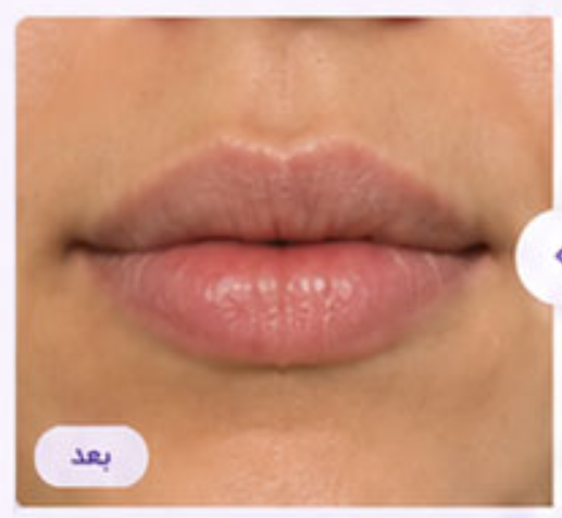 بعد