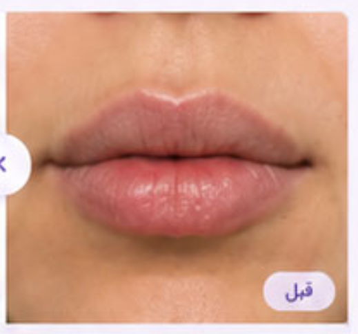 قبل